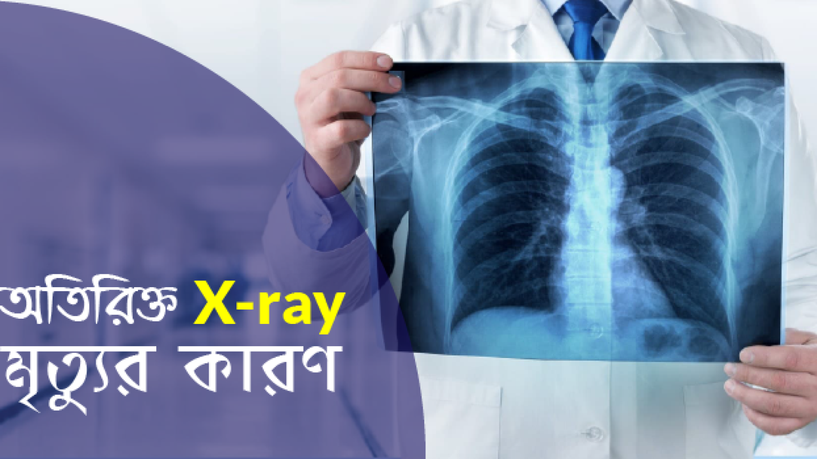অতিরিক্ত X-ray মৃত্যুর কারণ-01